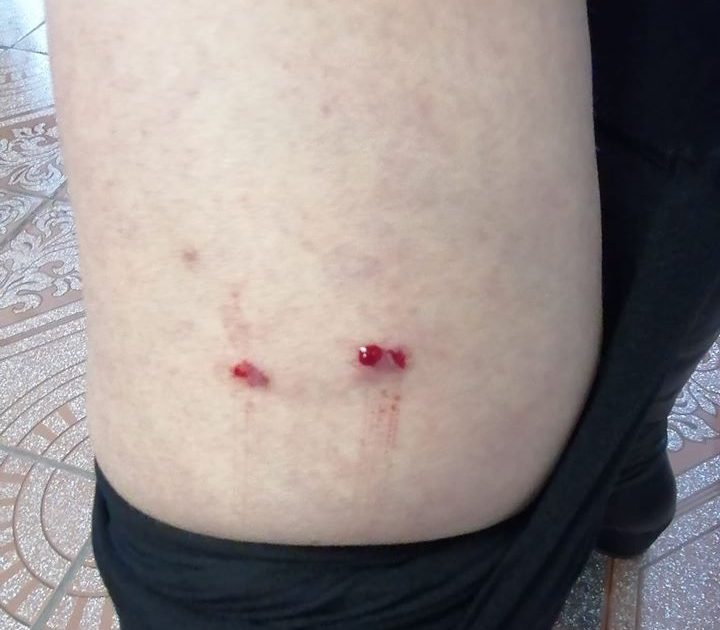 Câini vagabonzi fac o nouă victimă în oraşul Moldova Nouă