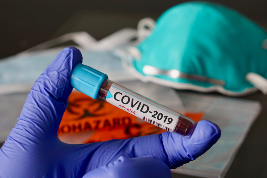 NEWS ALERT:8.651 de cazuri noi de persoane infectate cu noul coronavirus, 146 de decese, 1.001 pacienţi internaţi la ATI!
