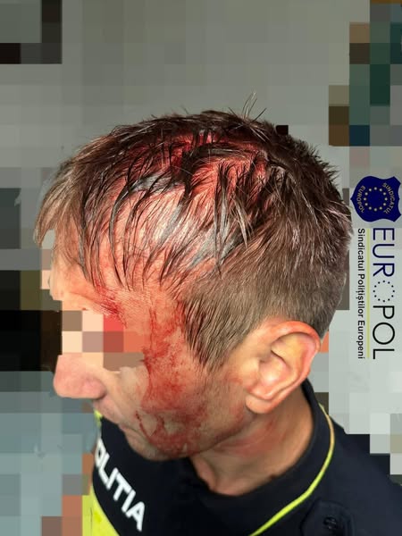 HAOS LA BOCȘA! POLIȚIȘTI ATACAȚI CU STICLE, AGRESORII LĂSAȚI LIBERI – EUROPOL: „LEGEA DOAR PENTRU UNII?”